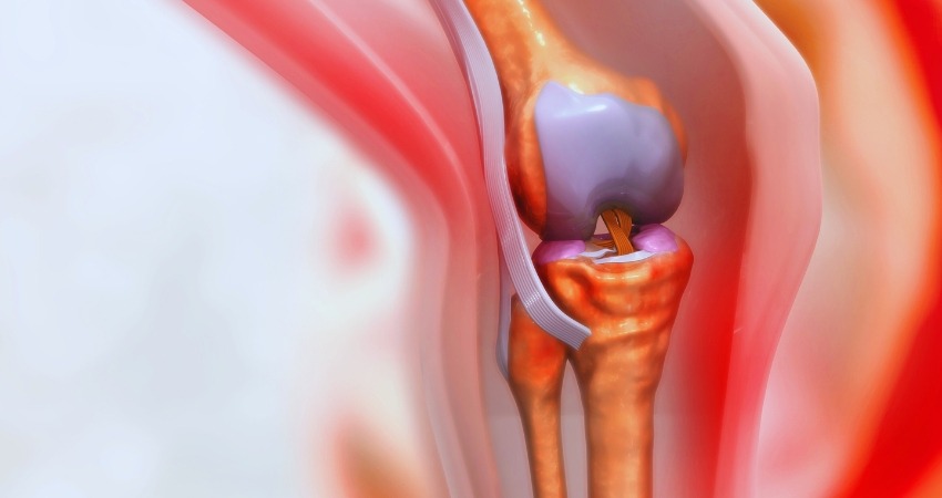 Dr Aayush Bhargava-Treatment-Knee Replacement