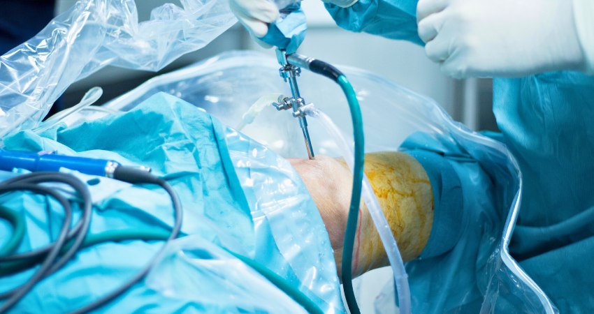 Dr Aayush Bhargava-Knee Arthroscopy